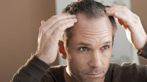 man looking at thinning hair in mirror